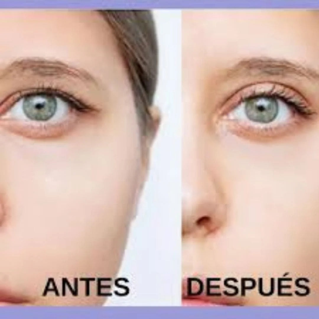 Cintas Levanta Parpados Caídos – Tu Mirada Joven al Instante
